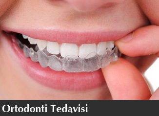 Ortodonti Tedavi